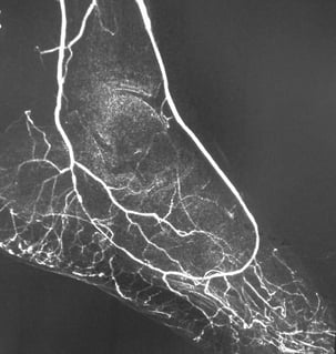 Abano Terme - Manzi - nov2019 Abano Terme - Manzi - nov2019