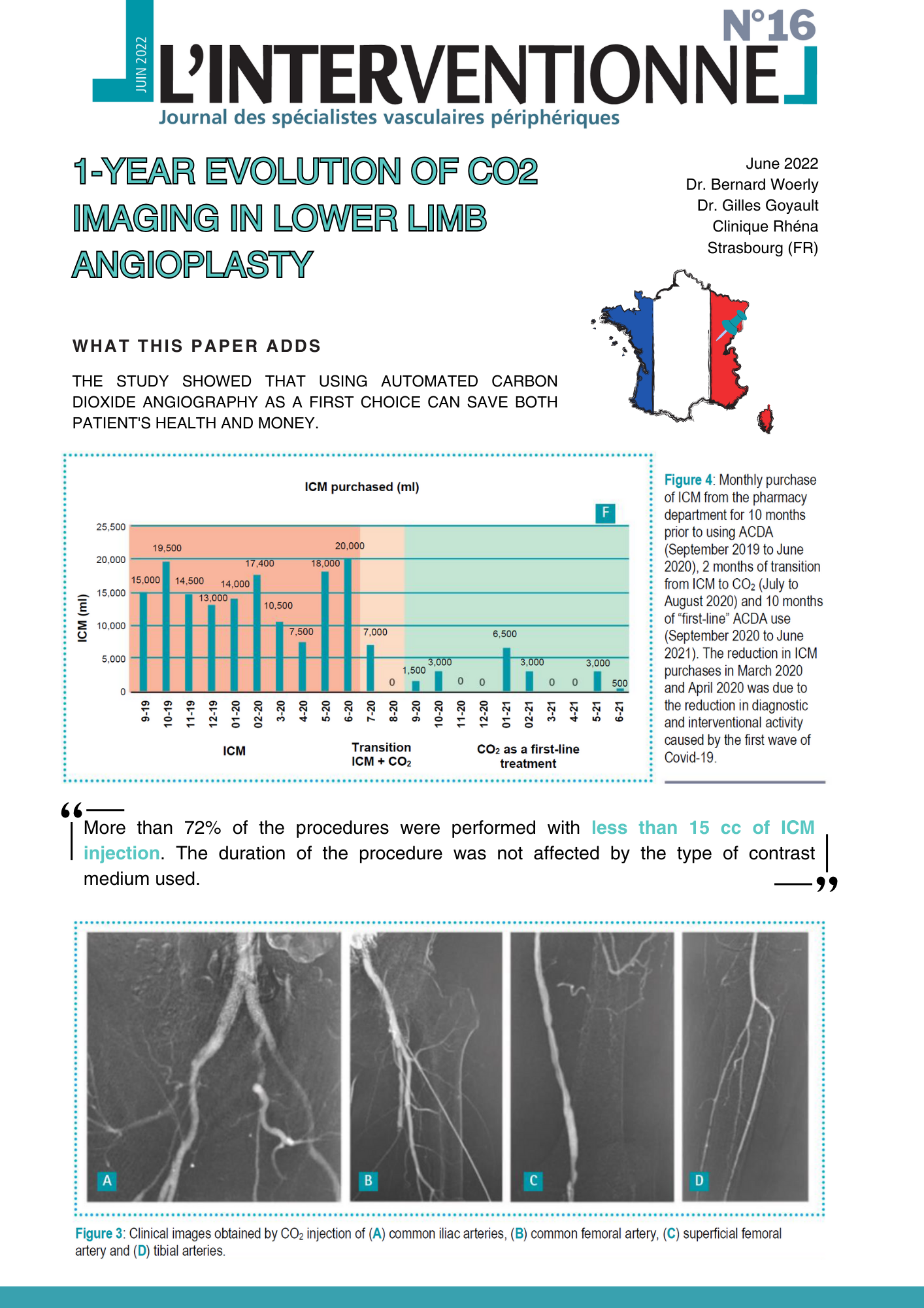 1-year evolution of CO2 imaging in lower limb angioplasty
