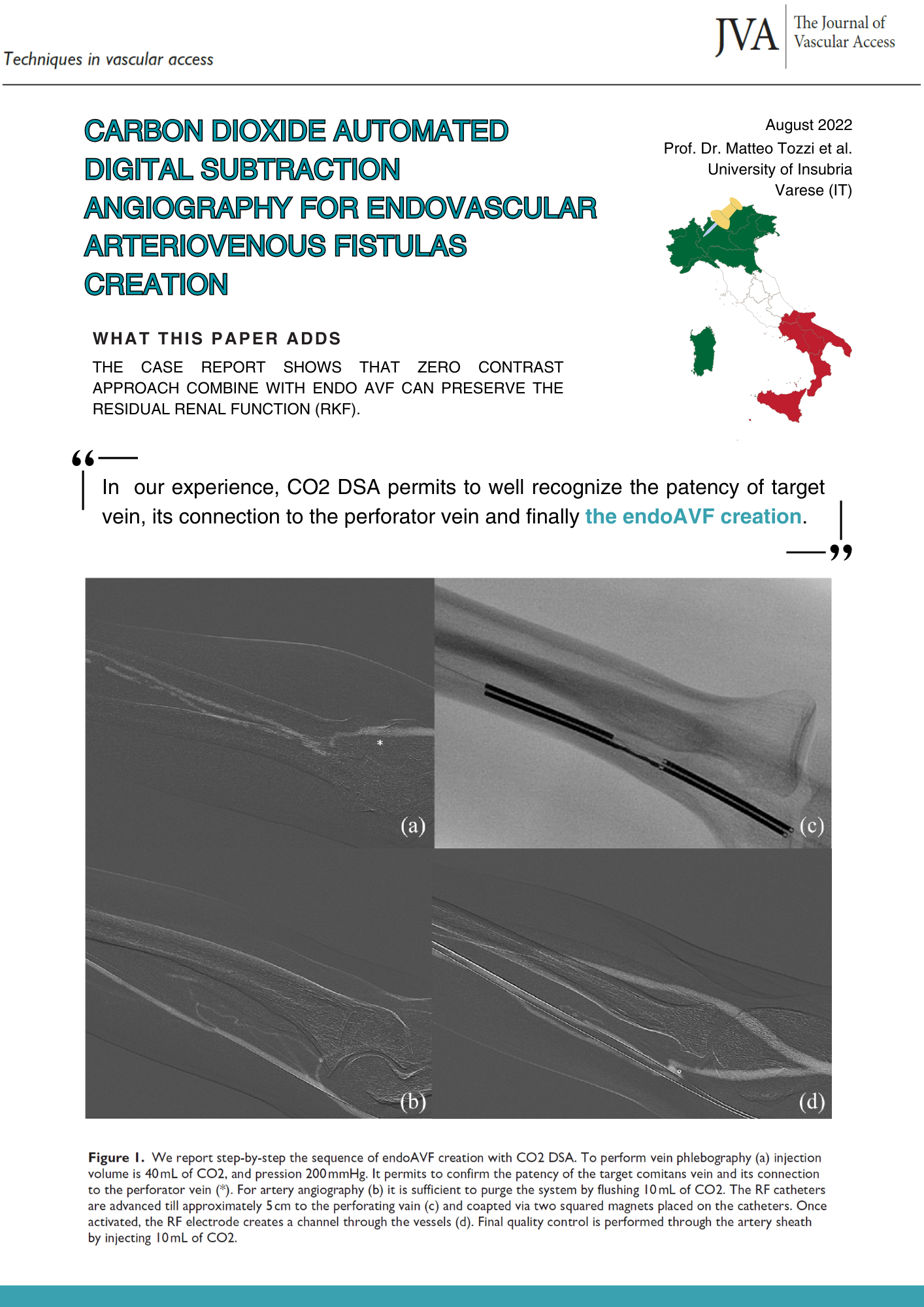 CO2 automated digital subtraction angiography for endoAVF creation