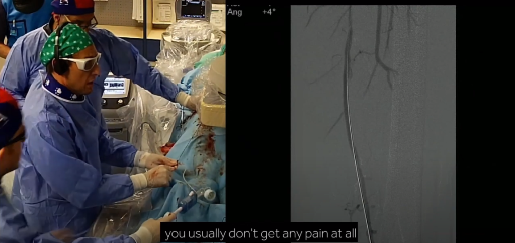 Angiodroid Live at British Society of Interventional Radiology (BSIR) 2019