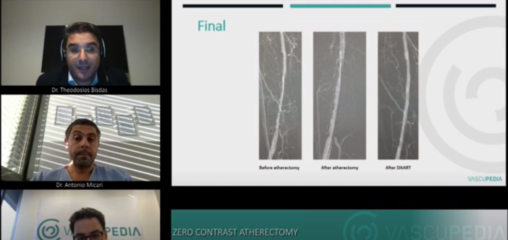 Zero-contrast directional atherectomy and antirestenotic therapy