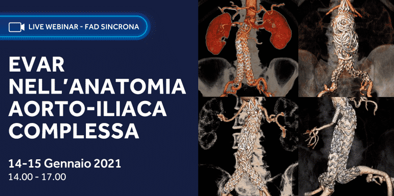 Webinar - EVAR nell'anatomia aorto-iliaca complessa